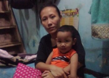 Anaknya Kelainan Usus Sejak Lahir, Mantan Satpam Ini Berjuang Sendirian