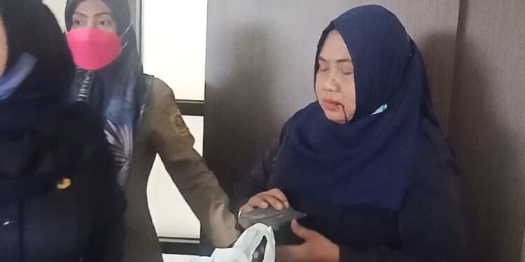 Secwan Kantor DPKPP Dipukul OTK Hingga Berdarah