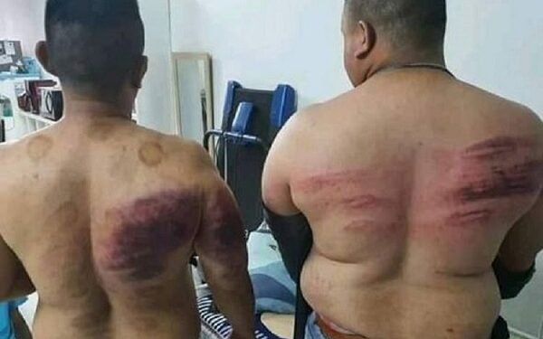 Dua Petugas Sekuriti Malaysia Dianiaya Majikan sebab Berpuasa