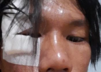 Mahasiswa Dikeroyok Oknum Satpam, LBH Pendidikan Indonesia Lapor Polisi