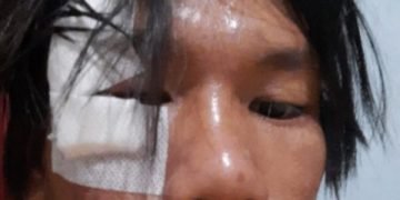 Mahasiswa Dikeroyok Oknum Satpam, LBH Pendidikan Indonesia Lapor Polisi
