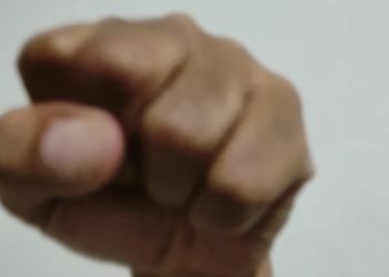 Merasa Jadi Korban Pemukulan, Satpam dan Kontraktor Saling Lapor ke Polisi