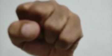 Merasa Jadi Korban Pemukulan, Satpam dan Kontraktor Saling Lapor ke Polisi