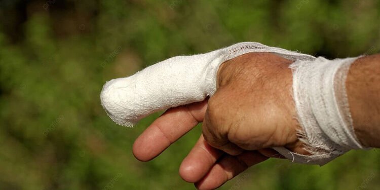 Jari Manis Satpam Putus Digigit Pencuri Sawit